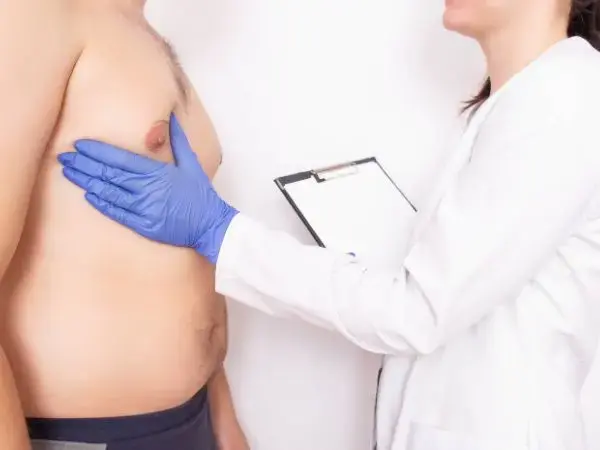 Ginekomastia: Twarzą w twarz z problemem nadmiernego rozwoju piersi u mężczyzn